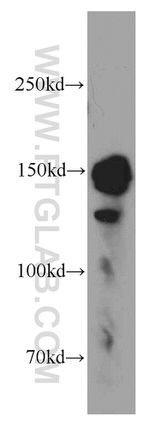 FAM129A Antibody in Western Blot (WB)