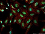 CHD2 Antibody in Immunocytochemistry (ICC/IF)