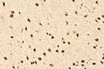 CHD2 Antibody in Immunohistochemistry (Paraffin) (IHC (P))