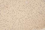CHD2 Antibody in Immunohistochemistry (Paraffin) (IHC (P))