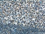 MTMR3 Antibody in Immunohistochemistry (Paraffin) (IHC (P))