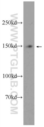 MTMR3 Antibody in Western Blot (WB)