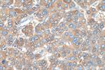C3/C3b/C3c Antibody in Immunohistochemistry (Paraffin) (IHC (P))