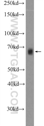 RBM39 Antibody in Western Blot (WB)