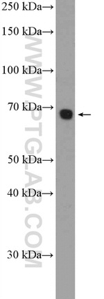 RBM39 Antibody in Western Blot (WB)