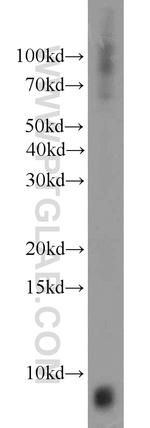 INE1 Antibody in Western Blot (WB)