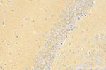 YIPF7 Antibody in Immunohistochemistry (Paraffin) (IHC (P))