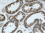 TMX4 Antibody in Immunohistochemistry (Paraffin) (IHC (P))