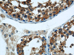 TMX4 Antibody in Immunohistochemistry (Paraffin) (IHC (P))