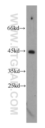 TMX4 Antibody in Western Blot (WB)