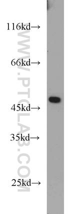 TMX4 Antibody in Western Blot (WB)