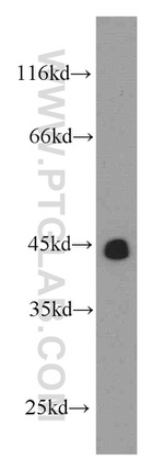 TMX4 Antibody in Western Blot (WB)
