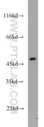 TMX4 Antibody in Western Blot (WB)