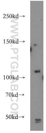 TRPC4 Antibody in Western Blot (WB)