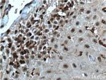 SNAI3 Antibody in Immunohistochemistry (Paraffin) (IHC (P))