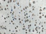 WDR82 Antibody in Immunohistochemistry (Paraffin) (IHC (P))