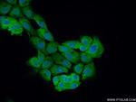 PLEKHO2 Antibody in Immunocytochemistry (ICC/IF)