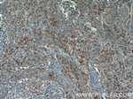 PLEKHO2 Antibody in Immunohistochemistry (Paraffin) (IHC (P))