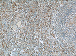 PLEKHO2 Antibody in Immunohistochemistry (Paraffin) (IHC (P))