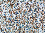 PLEKHO2 Antibody in Immunohistochemistry (Paraffin) (IHC (P))