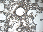 PLEKHO2 Antibody in Immunohistochemistry (Paraffin) (IHC (P))