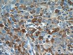 PLEKHO2 Antibody in Immunohistochemistry (Paraffin) (IHC (P))