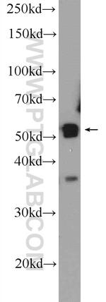 PLEKHO2 Antibody in Western Blot (WB)