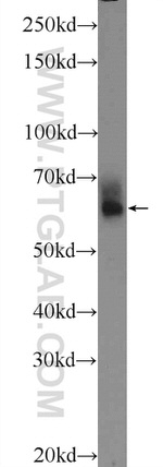 PLEKHO2 Antibody in Western Blot (WB)