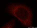 ITGB1BP2 Antibody in Immunocytochemistry (ICC/IF)