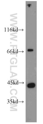 ITGB1BP2 Antibody in Western Blot (WB)