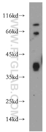 ITGB1BP2 Antibody in Western Blot (WB)