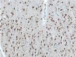 CCDC55 Antibody in Immunohistochemistry (Paraffin) (IHC (P))