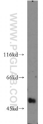 UGT3A2 Antibody in Western Blot (WB)