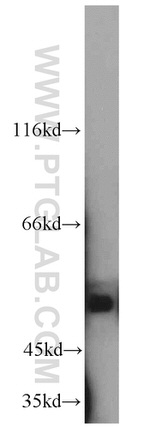 UGT3A2 Antibody in Western Blot (WB)