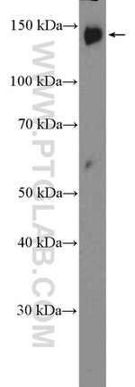 PLCB3 Antibody in Western Blot (WB)