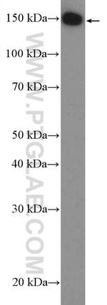 PLCB3 Antibody in Western Blot (WB)