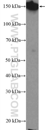 PLCB3 Antibody in Western Blot (WB)