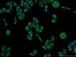 ECM2 Antibody in Immunocytochemistry (ICC/IF)