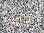 ECM2 Antibody in Immunohistochemistry (Paraffin) (IHC (P))