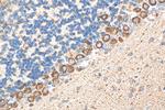 ECM2 Antibody in Immunohistochemistry (Paraffin) (IHC (P))