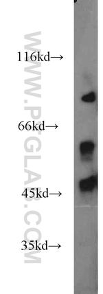 ECM2 Antibody in Western Blot (WB)