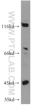 ECM2 Antibody in Western Blot (WB)