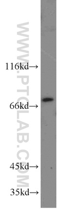 SASS6 Antibody in Western Blot (WB)