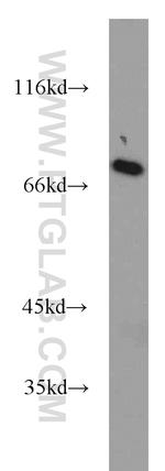 SASS6 Antibody in Western Blot (WB)