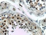 GTF2A1 Antibody in Immunohistochemistry (Paraffin) (IHC (P))