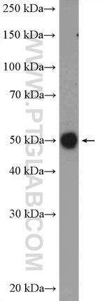 GTF2A1 Antibody in Western Blot (WB)