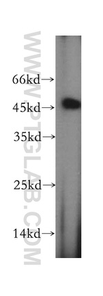 CCDC153 Antibody in Western Blot (WB)