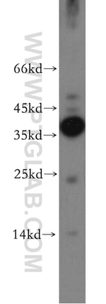 RLBP1L2 Antibody in Western Blot (WB)