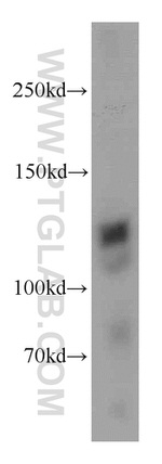 ERC2 Antibody in Western Blot (WB)
