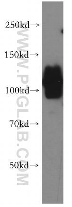 ERC2 Antibody in Western Blot (WB)